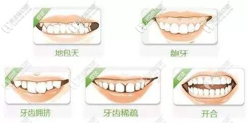牙齿不齐的各种症状