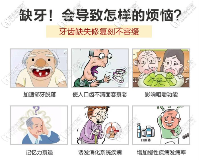 缺牙的危害 缺牙的危害