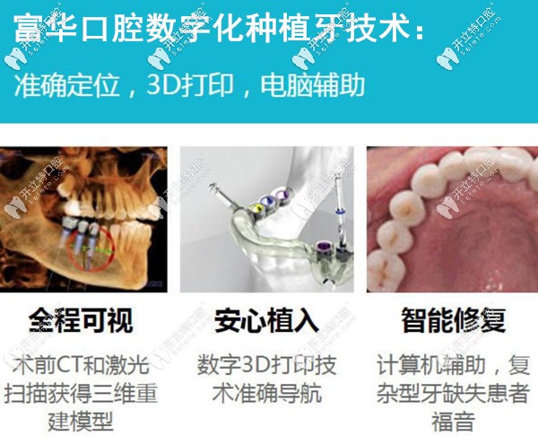 深圳富华口腔数字化种植牙技术