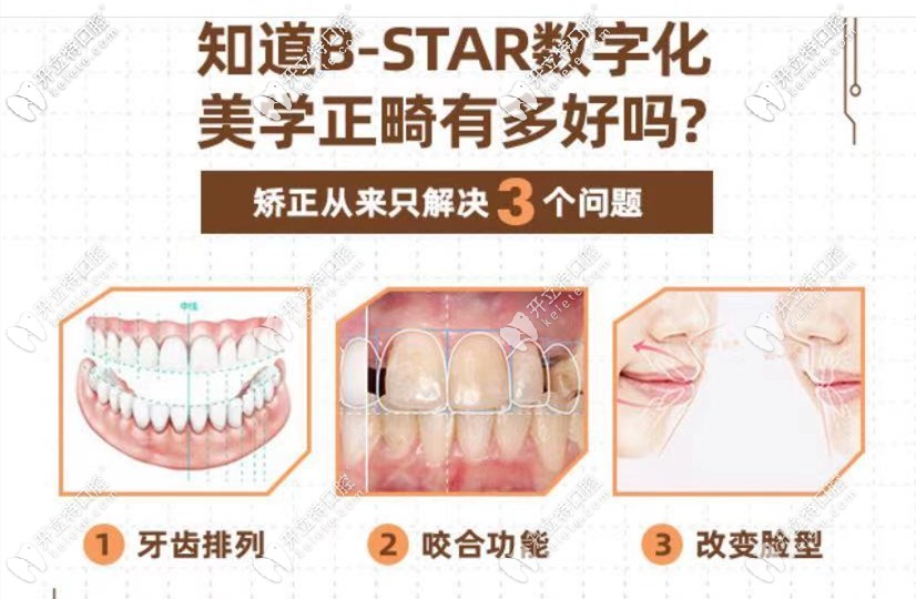 数字化矫正优势 数字化矫正优势