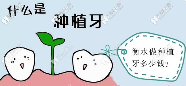衡水种植牙价格是多少钱 衡水种植牙价格是多少钱