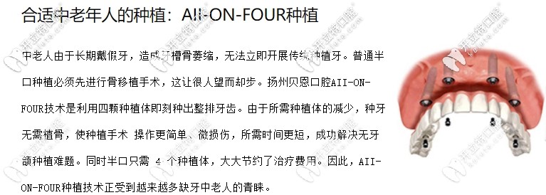 all on 4种植牙介绍 all on 4种植牙介绍