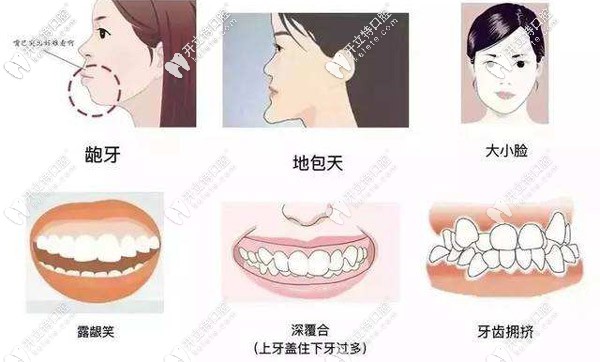 你是否有地包天、虎牙、龅牙、牙列不齐等牙齿问题