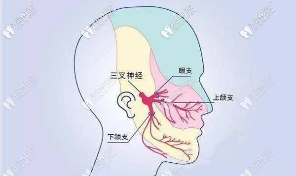 三叉神经痛也会引起牙疼