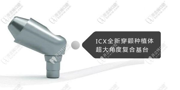 ICX全新穿颧种植体超大角度复合基台