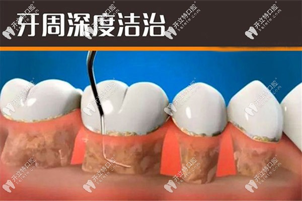 丹麦水冷激光患者评价