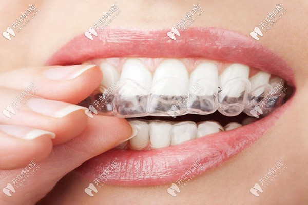 玉林牙科医院牙齿矫正价目表