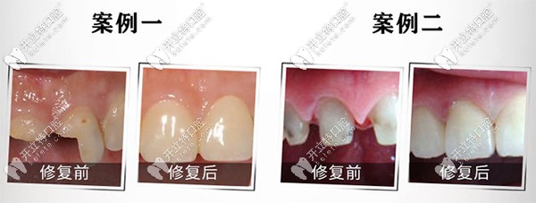 zenostar威兰德案例 zenostar威兰德案例