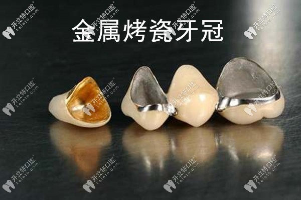 柳州华山口腔医院的烤瓷牙
