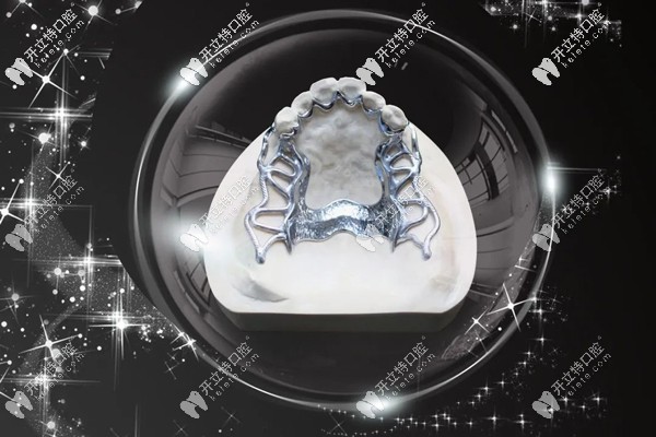 3d打印纯钛支架VS传统纯钛支架义齿