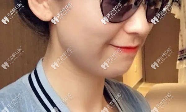 两年的时间牙齿变化蛮大的 两年的时间牙齿变化蛮大的