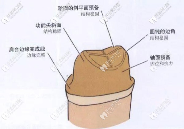 颌面的牙冠预备工作