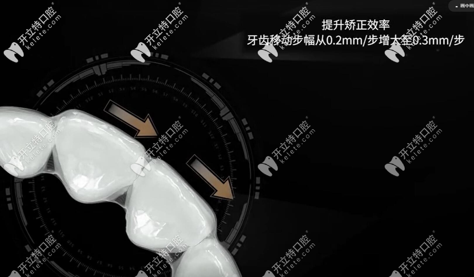 达芬奇Apo双膜隐形牙套效果怎么样