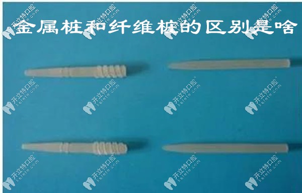 金属桩和纤维桩的区别 金属桩和纤维桩的区别