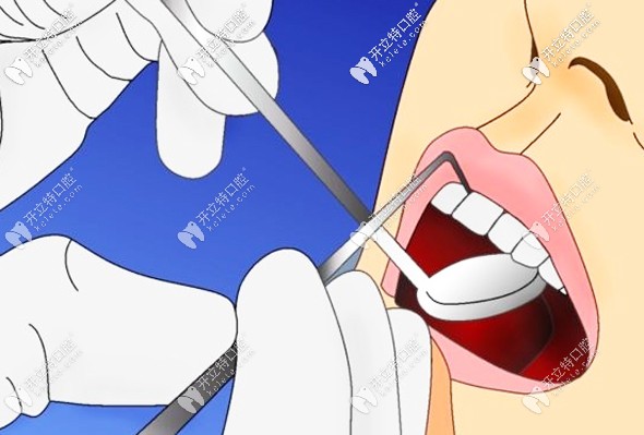 种植牙前应先治疗口腔疾病