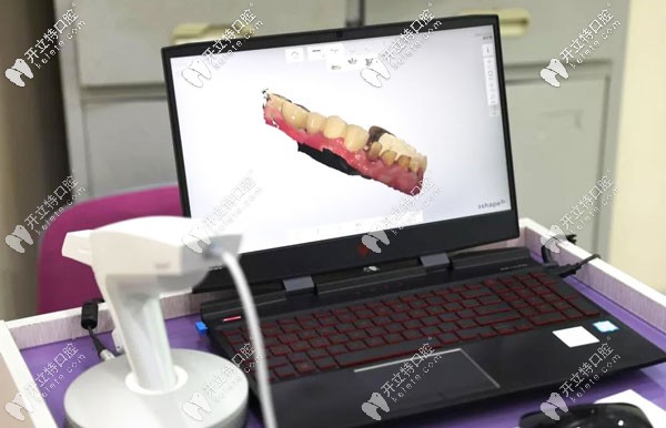 <!--<i data=20240703-sp></i>-->欧美洁口腔有自己的义齿加工中心