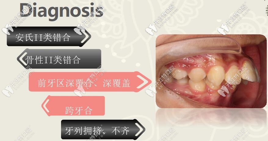 口腔诊断