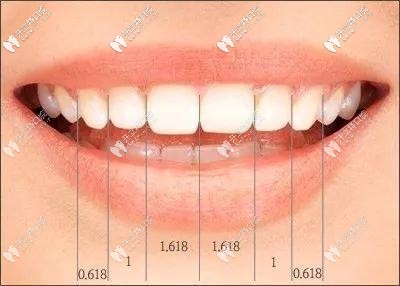牙齿微笑曲线
