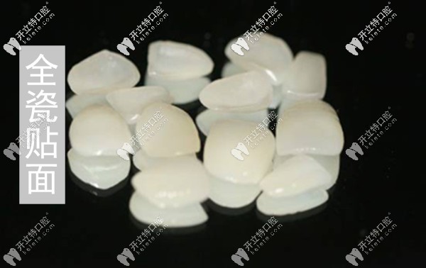 合肥贝杰口腔全瓷贴面修复的价格 合肥贝杰口腔全瓷贴面修复的价格
