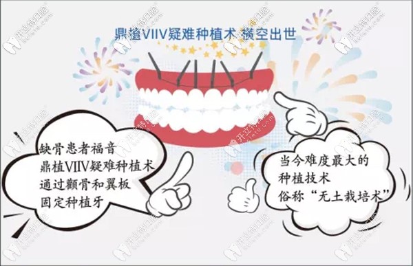 湖州鼎植VIIV疑难种植术