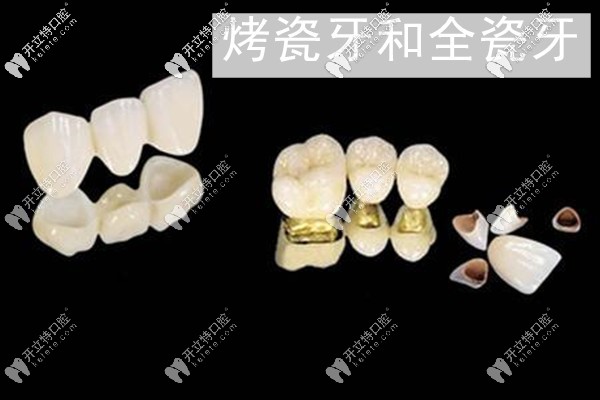 东莞莞大口腔做牙冠的价格 东莞莞大口腔做牙冠的价格