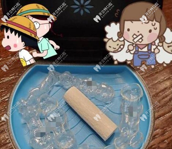 隐适美矫正器
