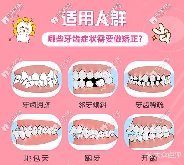 哪些牙齿问题需要矫正