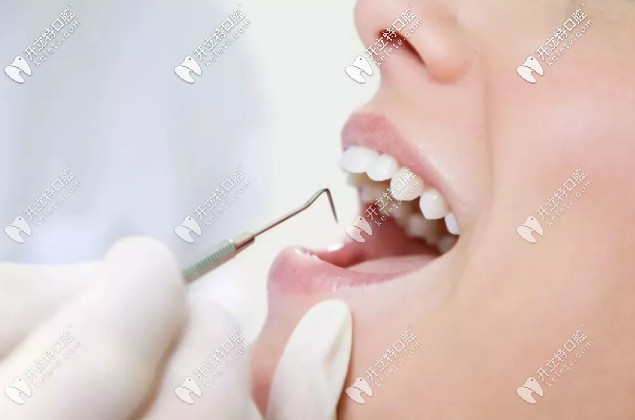 牙周治疗