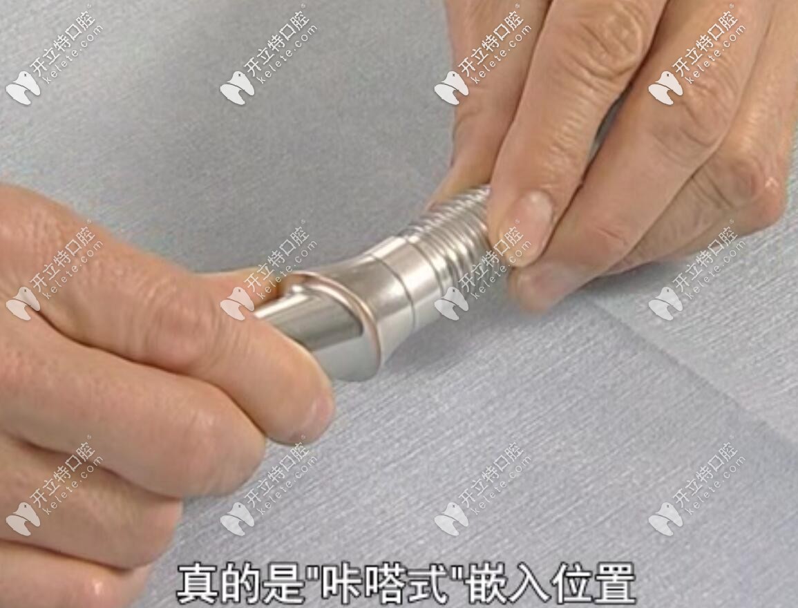 植体和基台连接演示