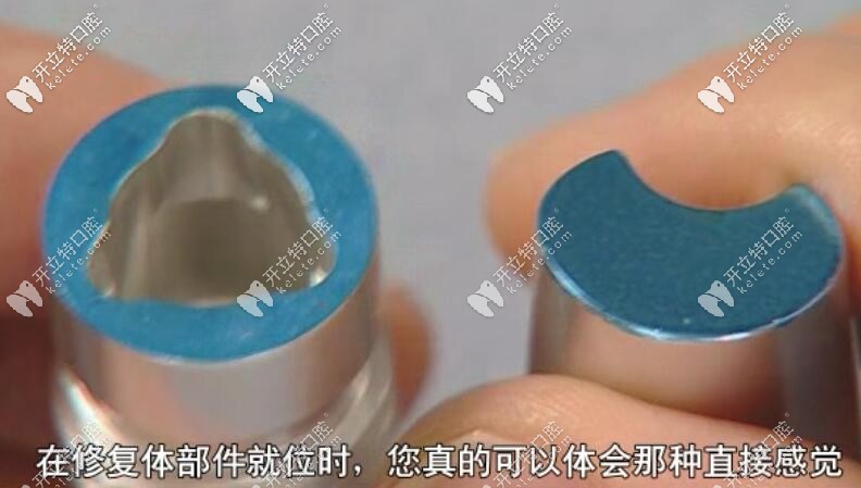 植体和基台没有结合前的图片