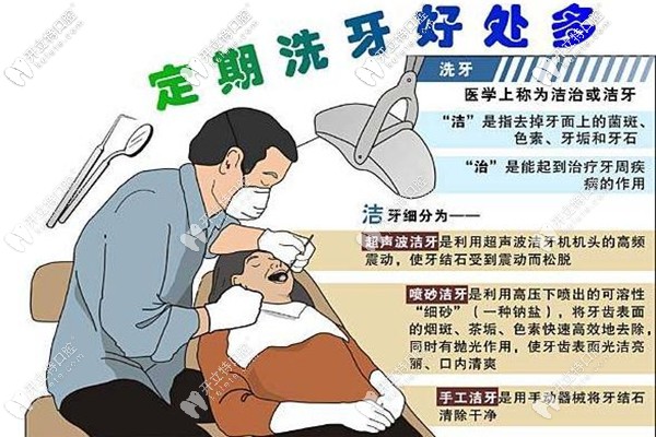 洗牙的好处 洗牙的好处