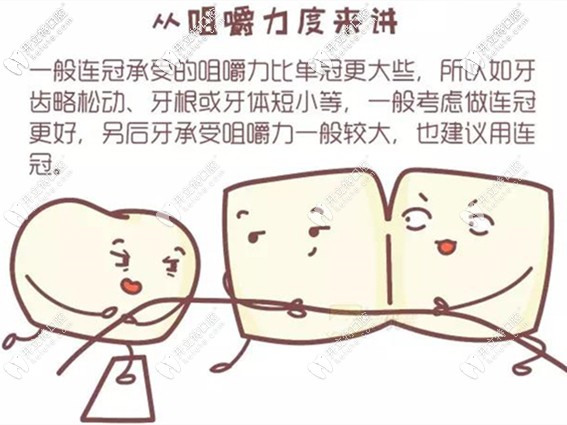 全瓷牙单冠好还是连冠好 全瓷牙单冠好还是连冠好