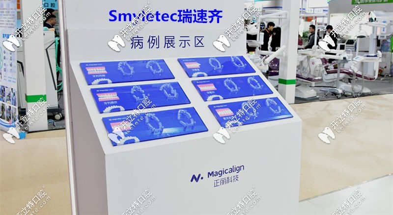 瑞速齐隐形牙套由:天津正丽科技和士卓曼集团联合推出的 瑞速齐隐形牙套由:天津正丽科技和士卓曼集团联合推出的