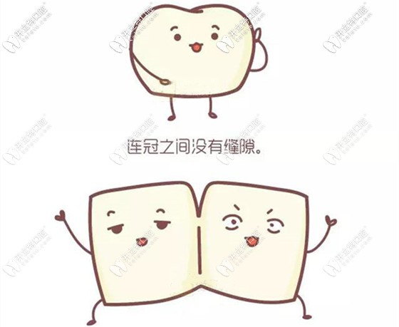 单冠和连冠全瓷牙的利弊 单冠和连冠全瓷牙的利弊