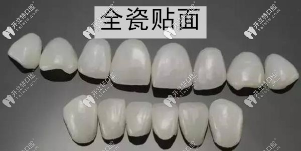 广州柏德口腔牙齿贴面多少钱