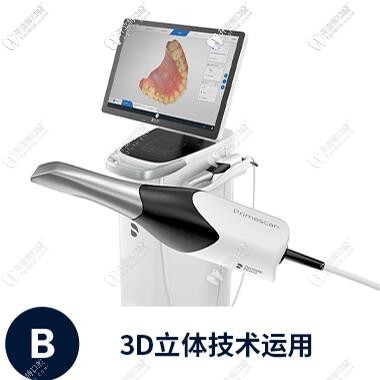 3D 黑科技可视化口扫 3D 黑科技可视化口扫