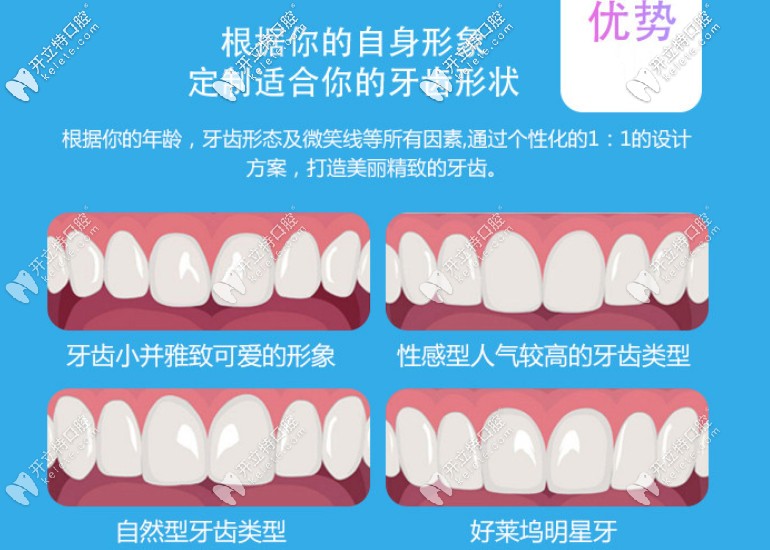 牙齿瓷贴面的优势
