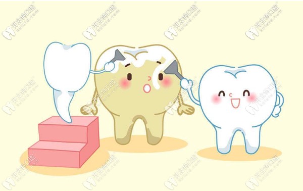 牙齿美白案例