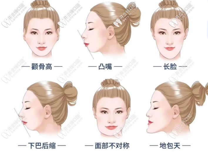牙齿矫正适应性 牙齿矫正适应性