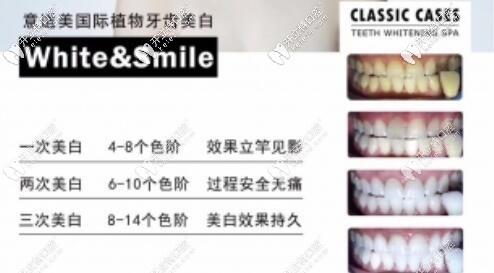 深圳正夫口腔植物牙齿美白优势 深圳正夫口腔植物牙齿美白优势