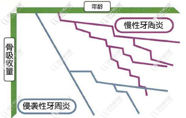 为什么有人会得侵袭性牙周炎