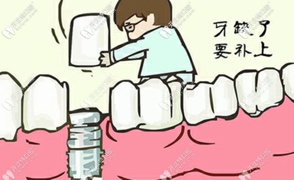 探查到湖州鼎植口腔医院院长苏艳国做种植牙的技术如何咯!