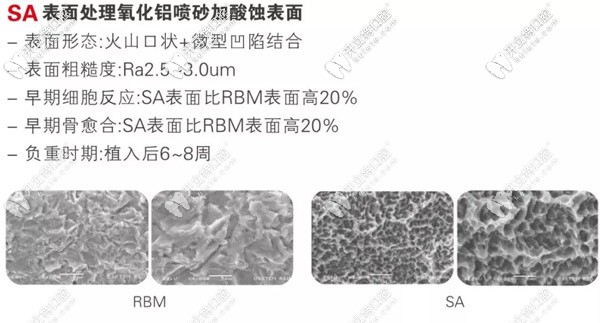 奥齿泰SA种植系统缩短了植入的时间