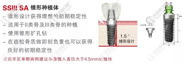 简析韩国奥齿泰SSIII SA种植体的优势,适用后磨牙缺失病例