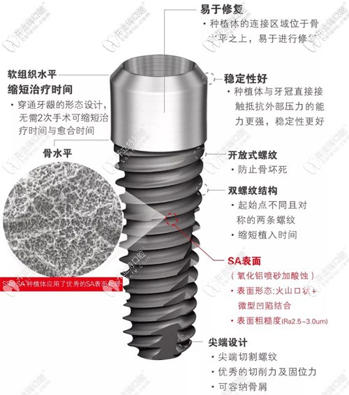 韩国奥齿泰SSIII SA种植系统的优势