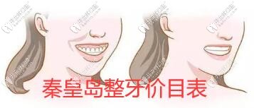来一份秦皇岛整牙价目表,看看各口腔医院收费标准是怎样的