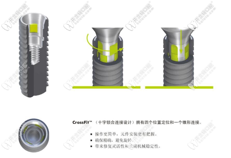 十字锁合连接示 十字锁合连接示