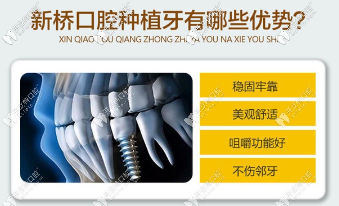 新桥口腔种植牙优势