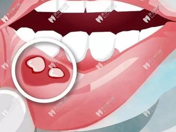 口腔疾病在牙科医院的挂号指南