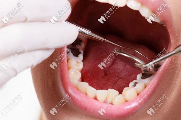 牙齿疾病在口腔科如何挂号